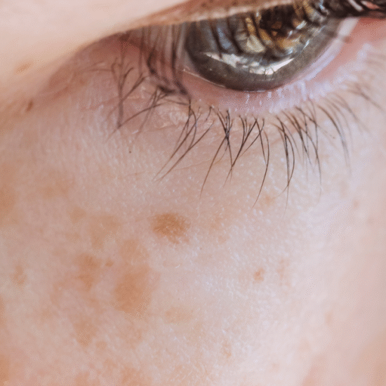 “taking vitamin d but skin is getting darker? The gene truth”