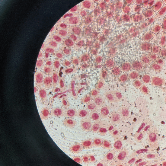 No more zombie cells: how to repair uv-damaged skin