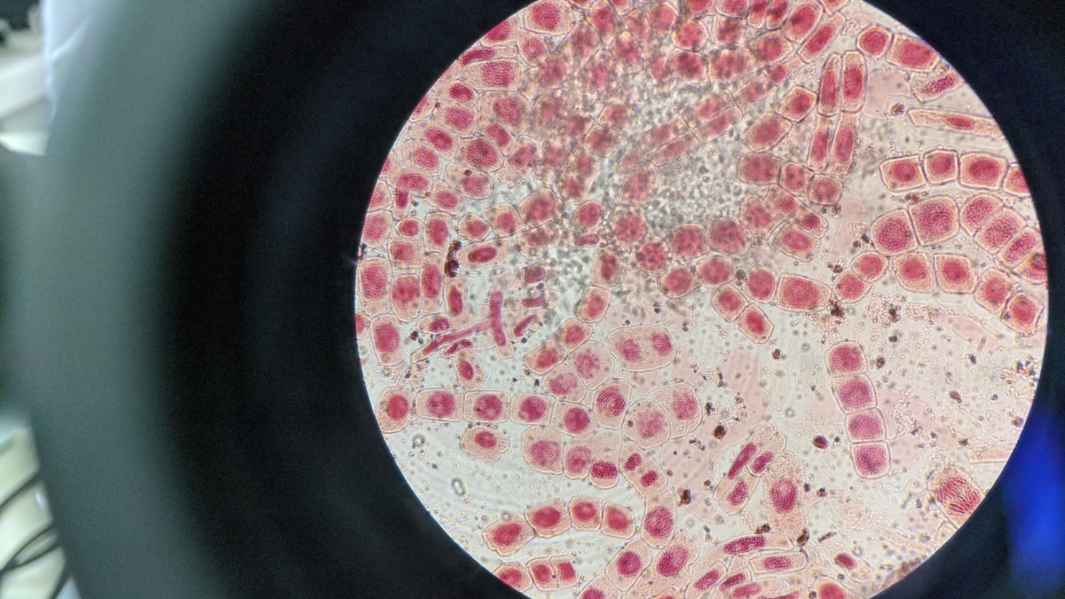 No more zombie cells: how to repair uv-damaged skin